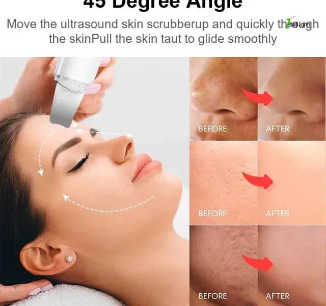 Скребок Xiaomi Mijia ультразвуковой кожи Ultrasonic Skin Scrubber scraper peel machine pore cleaner kosmetolog